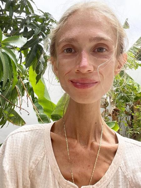 Karolina Krzyzak khi suy kiệt